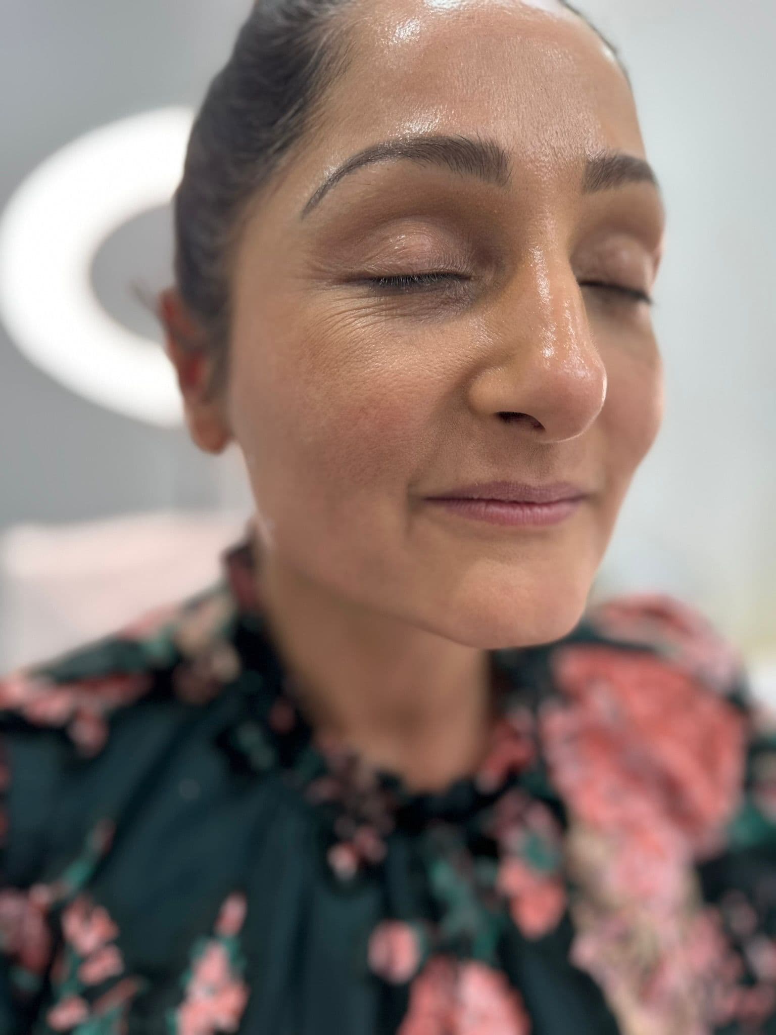 Skin Boosters & Injectables treatments at DZ Beauty Birmingham